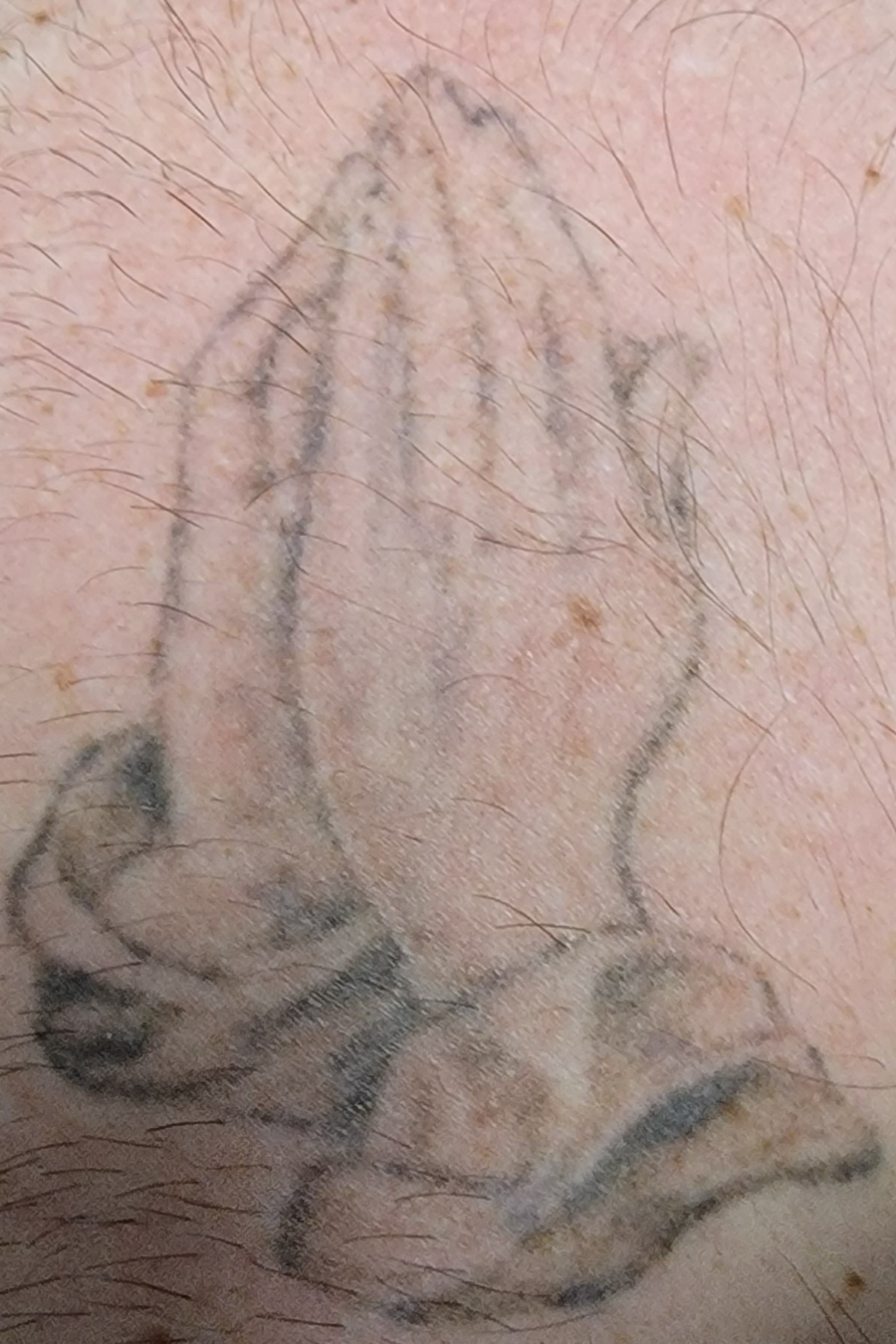 Hands Tattoo Before
